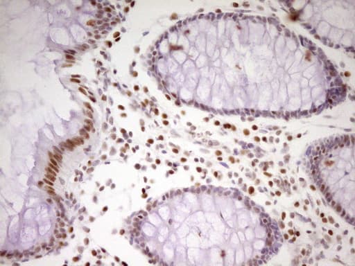 MEF2D Antibody (aa1-282, clone OTI10B4, Carrier-free)