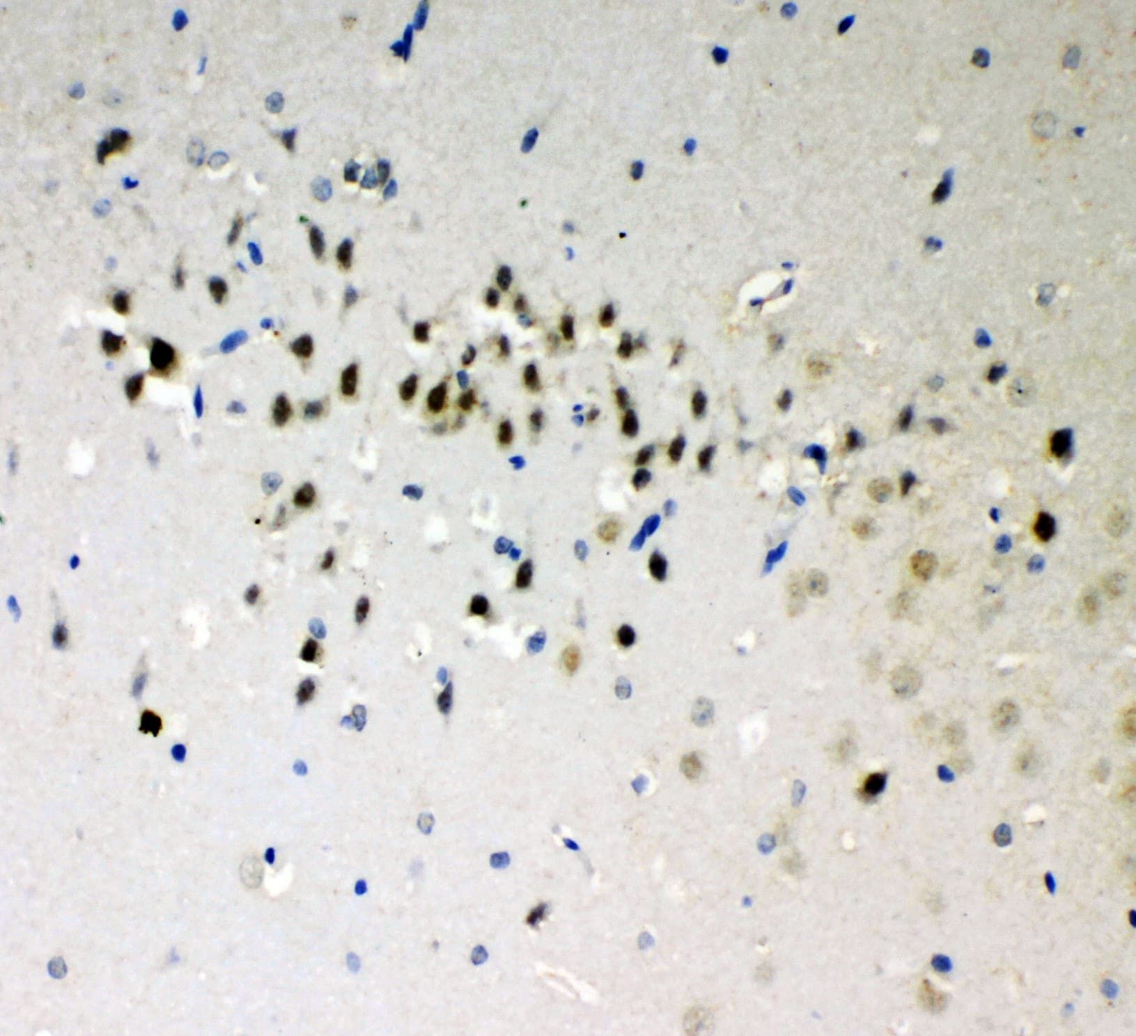 Polyclonal Rabbit anti-Human DDX5 Antibody (aa566-580, IHC, WB)