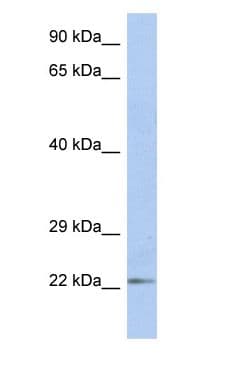 Polyclonal Rabbit anti-Human DUT / DUTPase Antibody (aa35-84, IHC, WB)