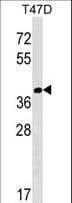 NTAN1 / PNAD Antibody (aa203-230)