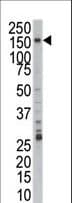 PRPF4B Antibody (aa948-978)