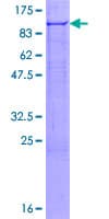 Human FBXO7 Protein (Recombinant GST)
