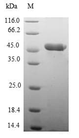 Human MYL7 Protein (Recombinant GST, N-terminus)