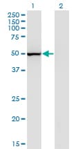 PGIS / PTGIS Antibody (clone 3B11)
