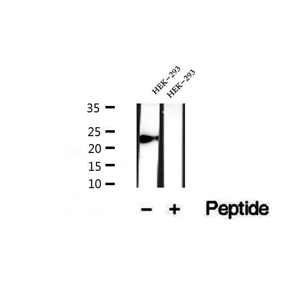 Polyclonal Rabbit anti-Human PPIC / Cyclophilin C Antibody (IHC, WB)