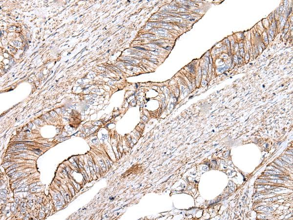 Polyclonal Rabbit anti-Human GHBP / BLVRB Antibody (IHC, WB)