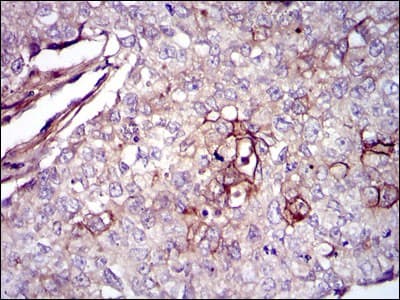 Monoclonal Mouse anti-Human FN1 / Fibronectin Antibody (clone 2F4, IHC, WB)