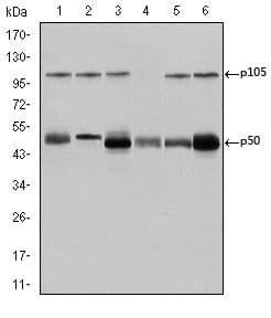 NFKB1 / NF-Kappa-B Antibody (clone 5D10)