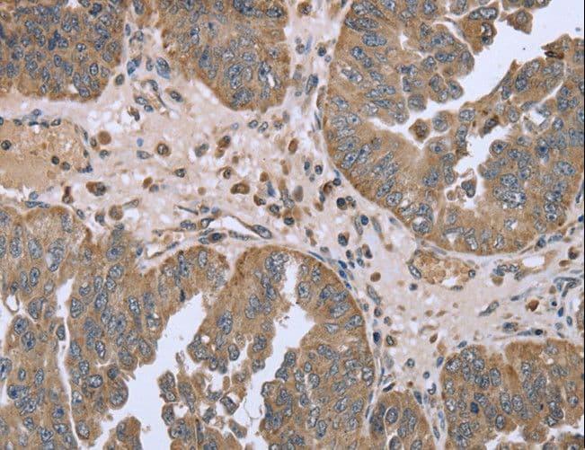 FANCG Antibody