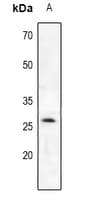PRSS2 / Trypsin 2 Antibody