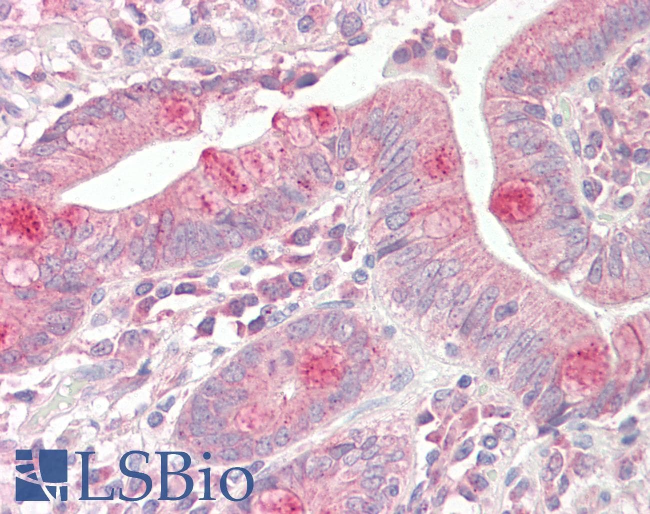IHC-plus™ VAMP7 / SYBL1 / T1 VAMP Antibody