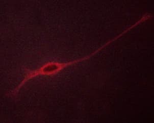 NTRK2 / TRKB Antibody (phospho-Tyr705)