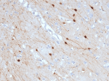 CALB2 / Calretinin Antibody (clone CALB2/2685, Ready-to-Use)