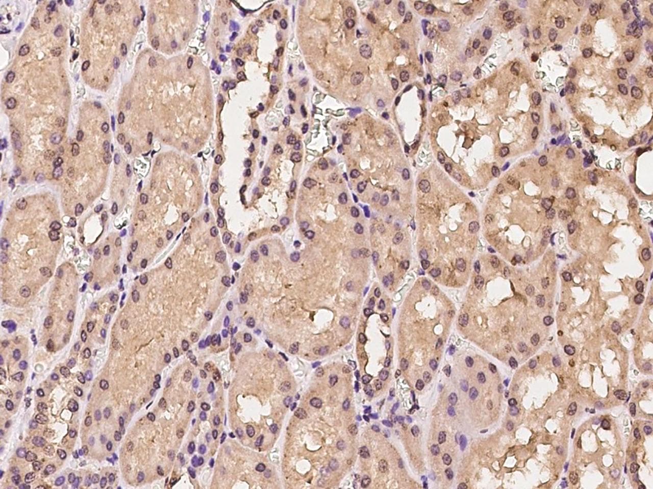 Polyclonal Rabbit anti-Human BTF3 Antibody (IHC, IF)