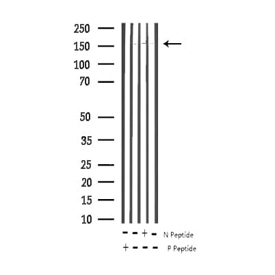 EGFR Antibody (phospho-Tyr1092)