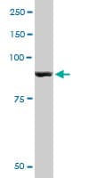 IHC-plus™ PYGM Antibody (clone 2C4)