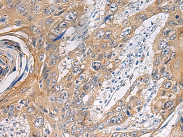 Polyclonal Rabbit anti-Human PA2G4 / EBP1 Antibody (IHC)