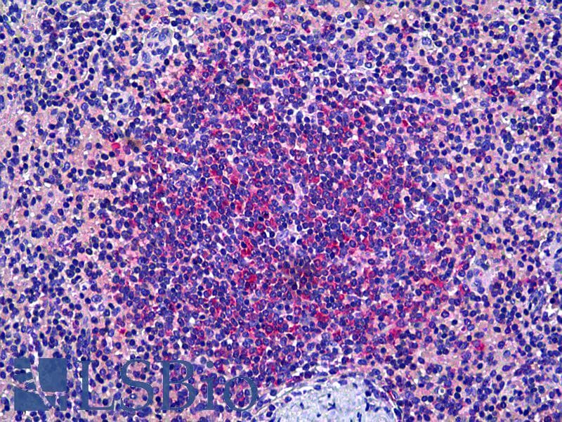 IHC-plus™ PRKD2 / PKD2 Antibody (clone 2E4)