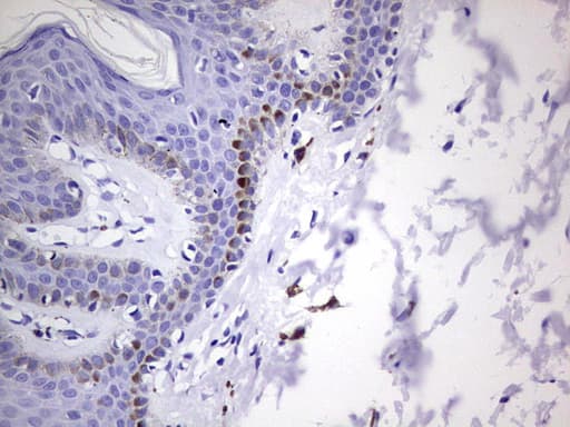 GLI / GLI1 Antibody (aa755-1106, clone OTI4A8)