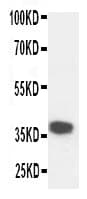 KLK5 / Kallikrein 5 Antibody (aa278-293)