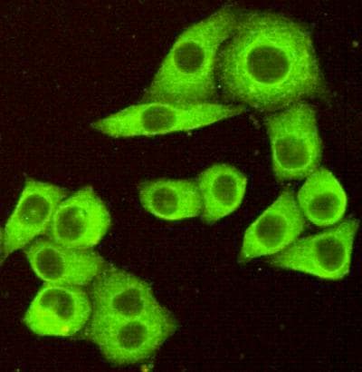 TNFRSF10B / Killer / DR5 Antibody