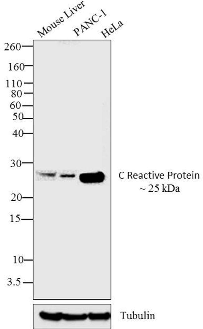 CRP / C-Reactive Protein Antibody (clone P4D7)