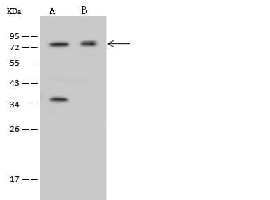 IFT81 Antibody