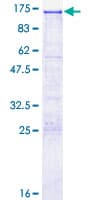 Human PSK / SEZ6L2 Protein (Recombinant GST)
