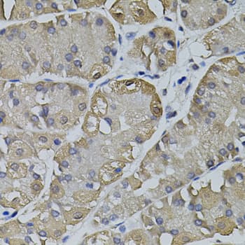 TRPC3 Antibody
