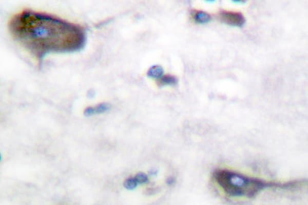 Polyclonal Rabbit anti-Human NTRK2 / TRKB Antibody (Asp699, IHC)