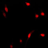 Polyclonal Rabbit anti-Human RELA / NFKB p65 Antibody (Internal, IHC, IF, WB)