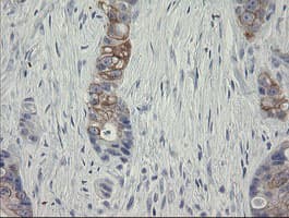 Monoclonal Mouse anti-Human SLA2 / SLAP2 Antibody (clone OTI1E7, IHC, WB)