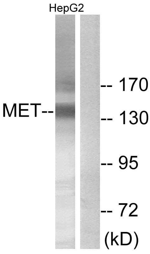 Polyclonal Rabbit anti-Human c-Met Antibody (aa1201-1250, WB)