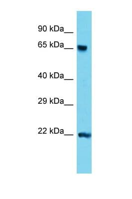 TDP1 Antibody (aa428-477)