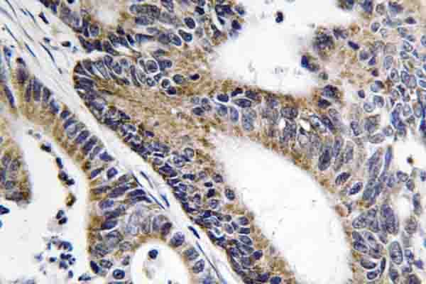 IQCB1 Antibody (Arg467)