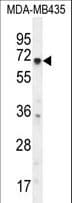 KCNQ1 / KVLQT1 Antibody (aa4-33)