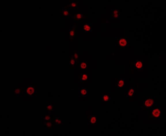 ERCC4 / XPF Antibody