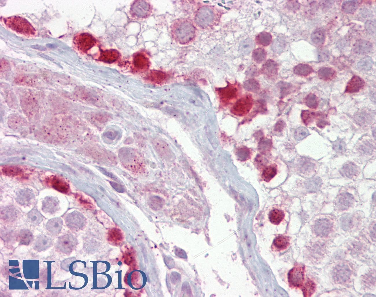 CRY1 Antibody (aa151-200)