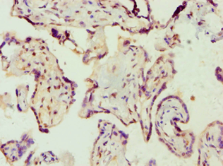 Polyclonal Rabbit anti-Human AMPD3 Antibody (aa1-260, IHC)