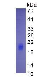 Human IL5 Protein (Recombinant His, N-Terminal)