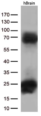 MAPT / Tau Antibody (aa623-758, clone OTI13B5)