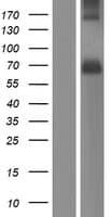 PACE4 / PCSK6 Protein (Over-Expression Lysate Myc-DDK (Flag))