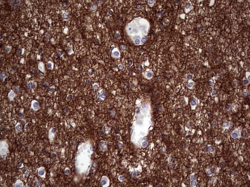 NCAM / CD56 Antibody (aa20-718, clone OTI1A3, Carrier-free)