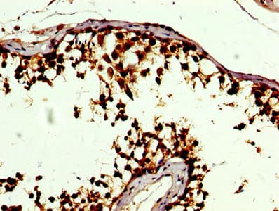 SOD3 Antibody
