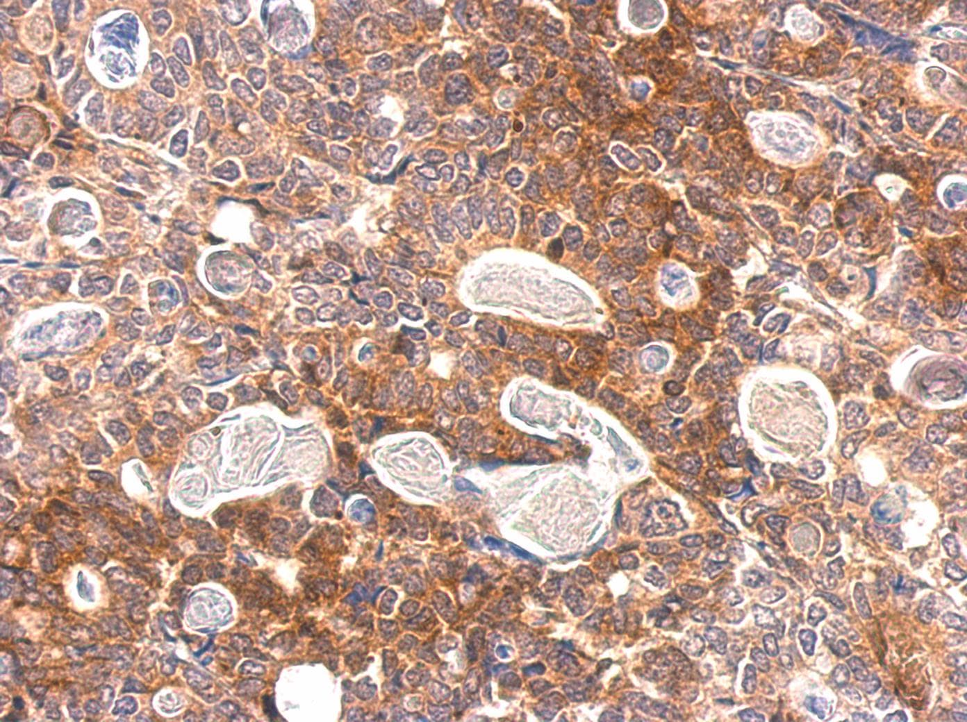 SLA Antibody (aa1-276)