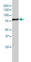 Monoclonal Mouse anti-Human ERCC2 / XPD Antibody (clone 4G2-2A6, WB)