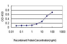 IHC-plus™ CYTH1 / Cytohesin-1 Antibody (clone 1D6)