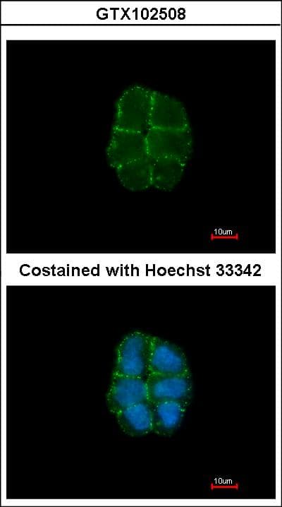 DSG2 / Desmoglein 2 Antibody (aa1-206)