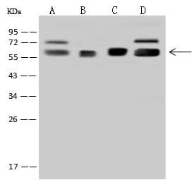 Polyclonal Rabbit anti-Human RNMT / HCM Antibody (IF, WB)