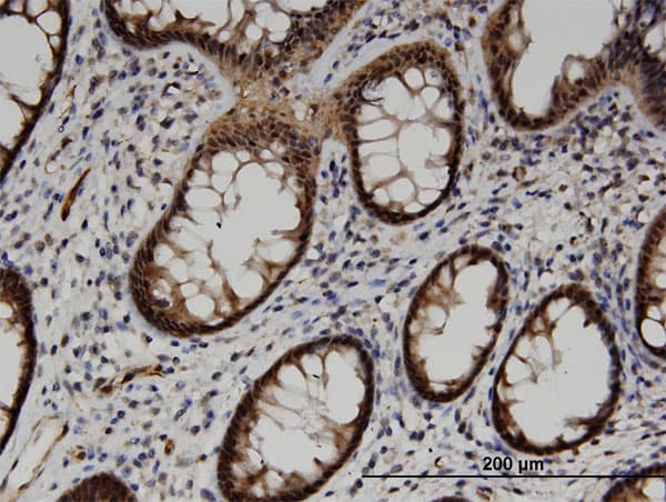 ACOT7 / BACH Antibody (clone 1E7)